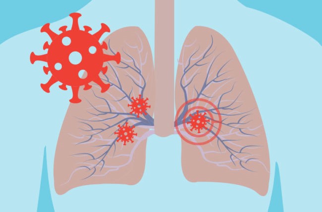 SARS-CoV-2 or nCOVID19: Why Breathing issues